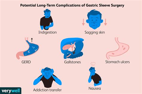 10 Years After Gastric Sleeve: Long-Term Success