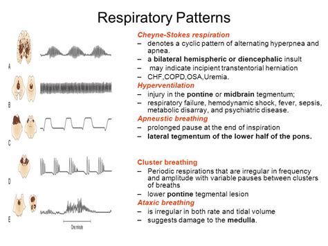 Respiratory Mnemonics