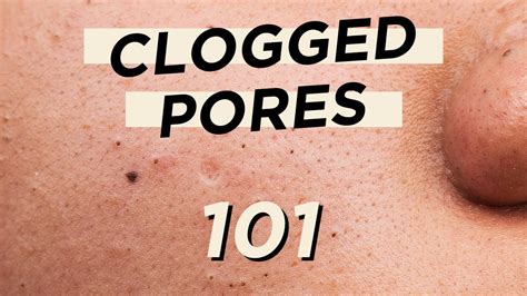 Clogged Pores After Makeup - Mugeek Vidalondon