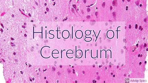 Cerebrum Histology Labeled