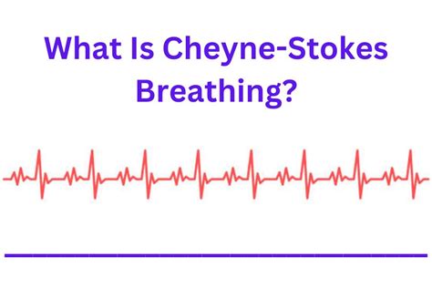 What Is Cheyne-Stokes Breathing?