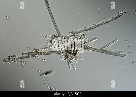 Mold filaments and spores from the Aspergillus mold under the microscope Stock Photo - Alamy