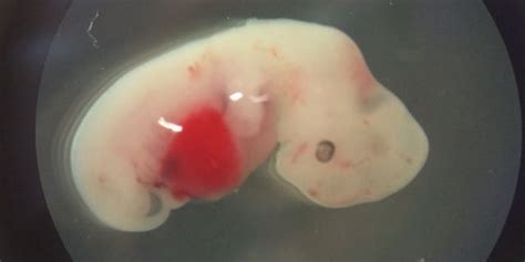 MEDICAL BREAKTHROUGH: Pig embryo hosts human cells | Fox News