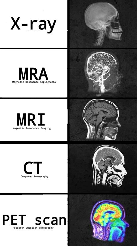 My favorite neuroimaging techniques. : r/memes