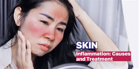 Skin Inflammation, Causes, and Treatment | Blog | www.lencolab.com