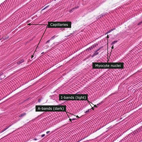 skeletal muscle l.s. | Human anatomy and physiology, Tissue biology, Medical anatomy