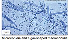 Microbiology Final (Molds, yeast, CRISPR) Flashcards | Quizlet