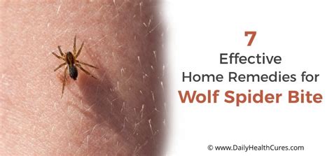 7 Home Remedies to Treat Wolf Spider Bite | Daily Health Cures