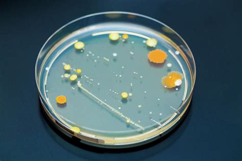 Bacteria Petri Dish Art