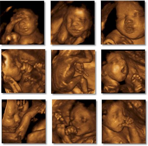 3d Ultrasound Pregnancy :: 3d Puzzle Image