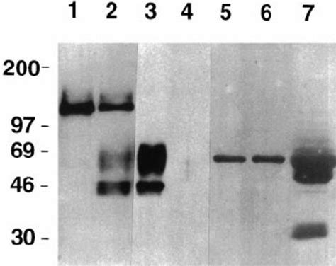 Western Blot Analysis of Membrane-Bound and Soluble Forms of Receptors... | Download Scientific ...