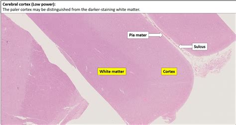 Brain – Cerebrum – NUS Pathweb :: NUS Pathweb