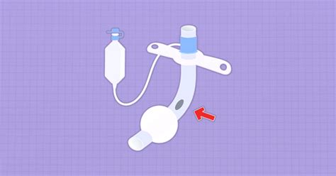 Fenestrated vs Non-Fenestrated Tracheostomy Tube [Explained]