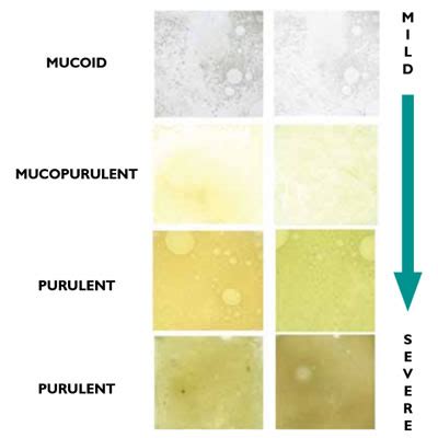 what does the color of phlegm mean healthsites in 2020 health chart - what does the color of ...