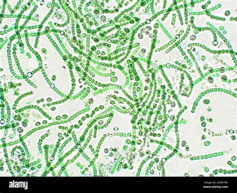 Cyanobacteria microscope hi-res stock photography and images - Alamy