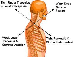 Shoulder Blade Posture and Shoulder Pain - Active Lifestyle Physiotherapy