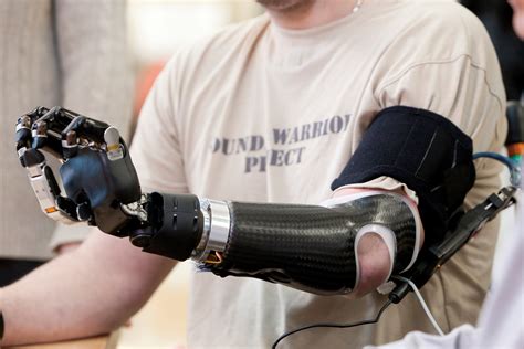 Robotic Prosthetics – Technology for the Future is Now - GizHub