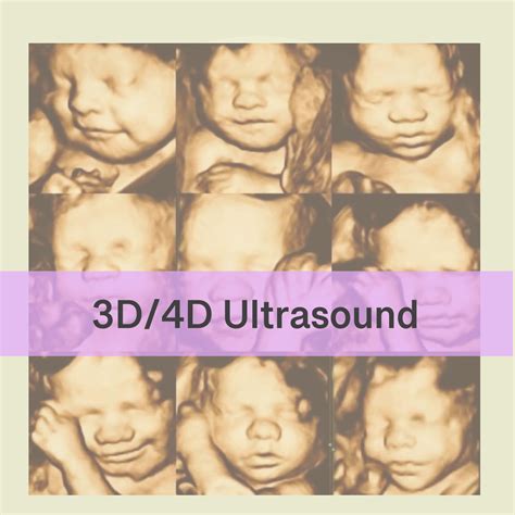 Home - Affordable 3D/4D Ultrasound in Houston Texas