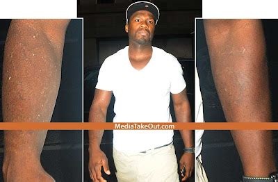 S.N.O.B SECRET'S: OMG WOOOwwzerr 50 Cent REMOVED His Tattoos...