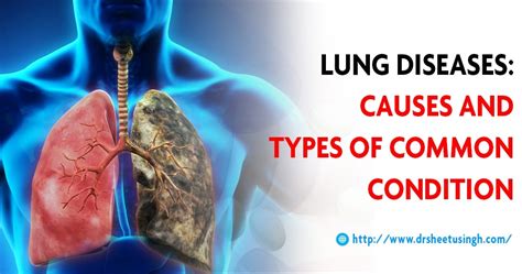 Lung Diseases: Types and Causes, Breathing Problem Symptoms & Risk