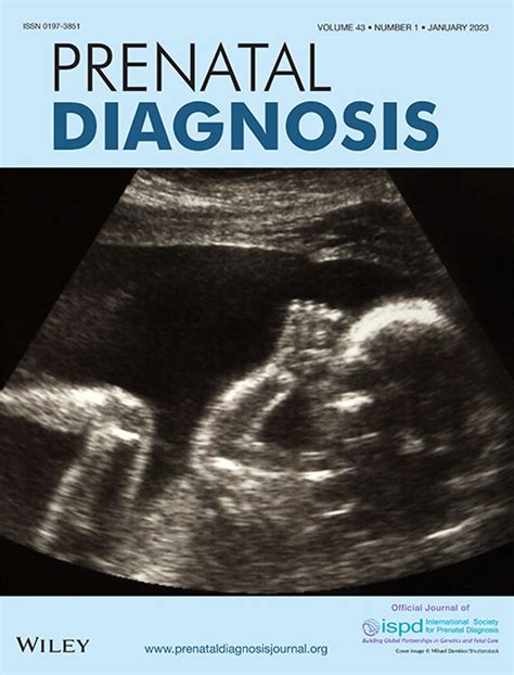 Trisomy 18 Ultrasound