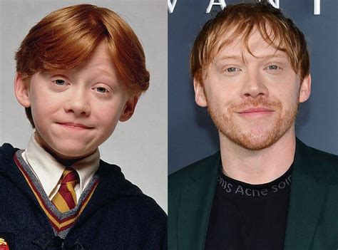 Harry Potter Casts Then And Now: Who Is The Most Successful One?