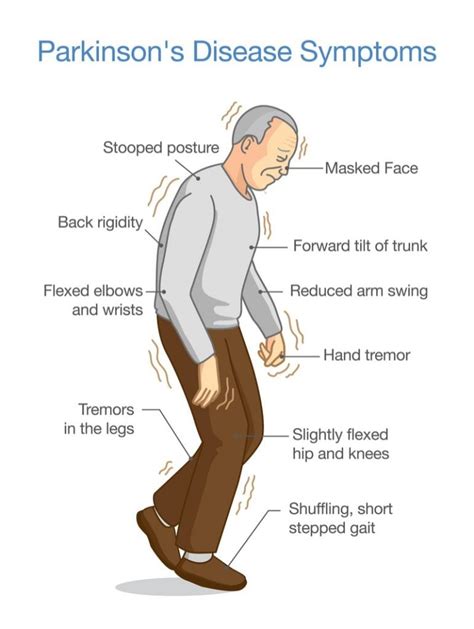 Axovant's Parkinson's Disease Gene Therapy Clinical Trial Launched in UK