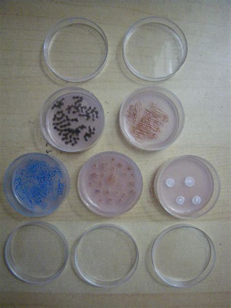 Petri dish culture by TotenPF on DeviantArt