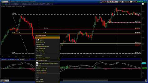 Top 10 Intraday Trading Indicators That Can Amplify Your Profits Today