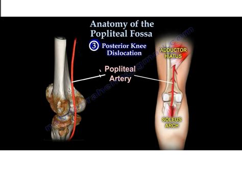 Popliteal Fossa Anatomy