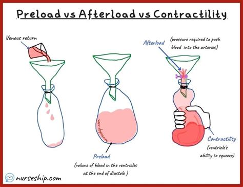 Cardiac Preload vs Afterload vs Contractility |With an example - Nurseship.com