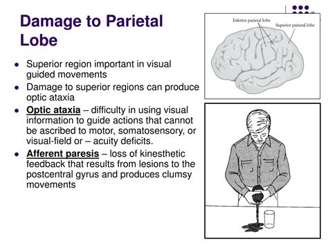 24+ Parietal Lobe Function Damage Pictures | 1000diagrams