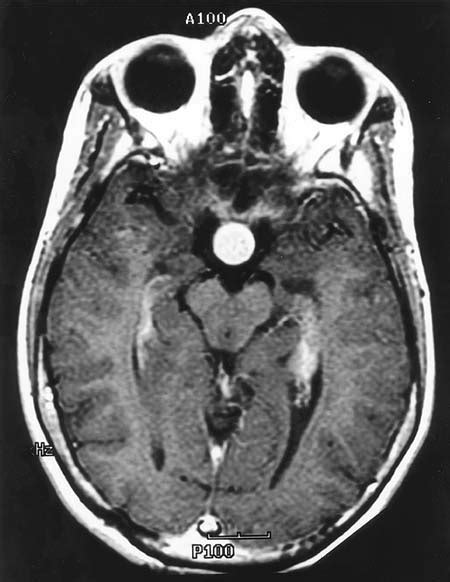 A Scan Of The Different Neuroimaging Techniques - Dr. Curtis Cripe