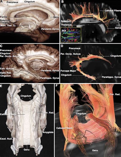 Cingulum | Neuroanatomy | The Neurosurgical Atlas