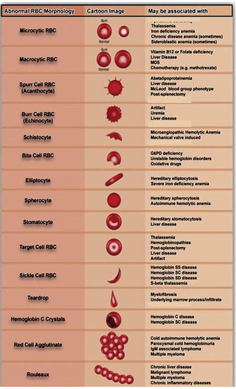 EUH Morning Report: What are common abnormal red blood cell morpologies, and which diseases are ...