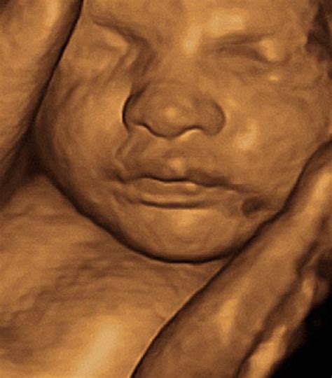 3d 30 Week Ultrasound: What To Expect? - Crying Toddlers