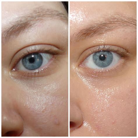 Before and After Retinol Eye Serum - Beauty Insider Community