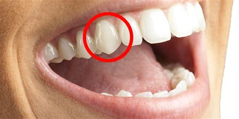 Why humans have canine teeth - Business Insider