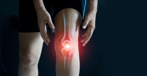 What Is Patellofemoral Pain Syndrome? | PainScale