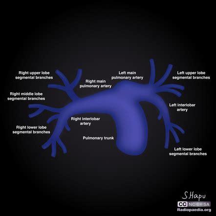 Pulmonary Arteries Anatomy - Anatomy Reading Source