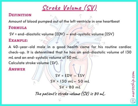 Cardiac Preload vs Afterload vs Contractility |With an example - Nurseship.com