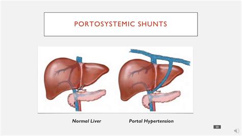 What Is Dog Liver Shunt