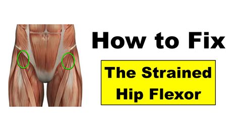 Hip Flexor Pain Causes