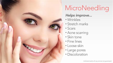 Microneedling and Microneedling with PRP • REN Dermatology