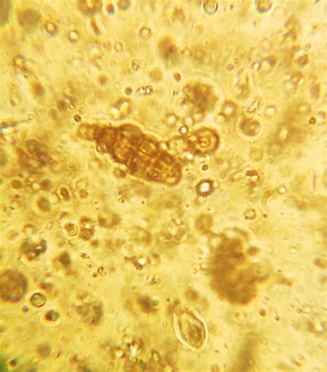 Microscopy of the Alternaria Fungus Macroconidia Stock Photo - Image of fungus, flavus: 178382694