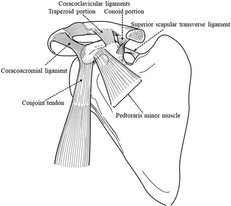 Muscles and ligaments attached to the coracoid process. The... | Download Scientific Diagram