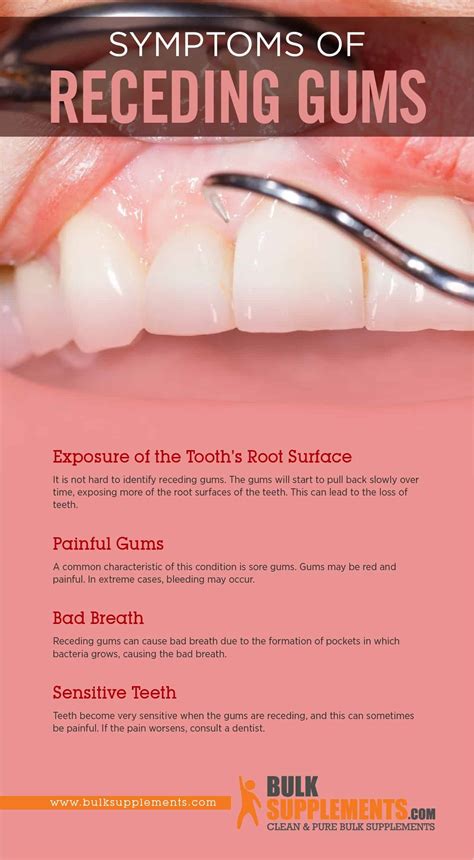 Receding Gums: Symptoms, Causes & Treatment