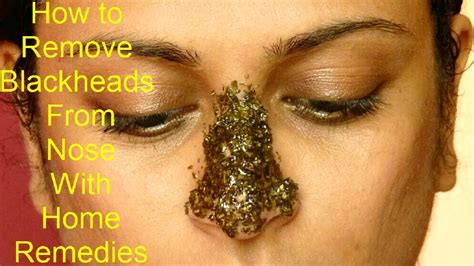 How Are Blackheads Formed - Blackheads Removal | New Pimple Popping Videos / But if it doesn't ...