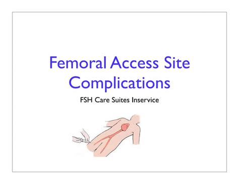 Femoral Site Complications | PPT