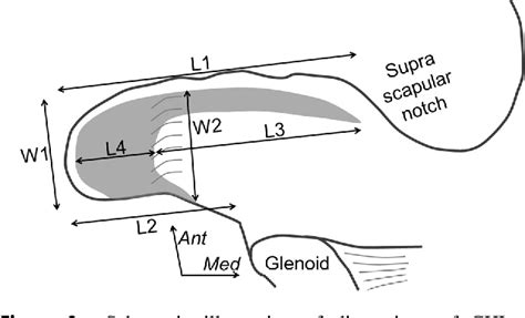 Figure 3 from The anatomy of the coracohumeral ligament and its relation to the subscapularis ...